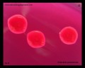 klebsiella pneumoniae colonies on Endo agar plate